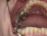 tandarts voor