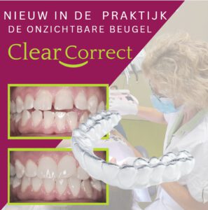 Binnenkort bij onze tandartspraktijk: ClearCorrect, de onzichtbare beugel!